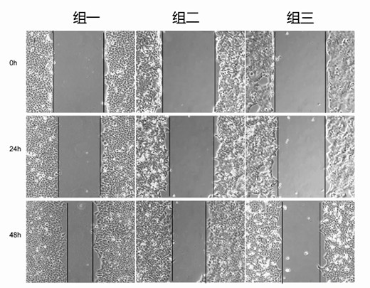 细胞划痕